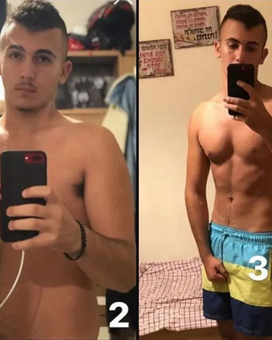 לפני ואחרי בשיטת ריקומפוזישן לצדדים